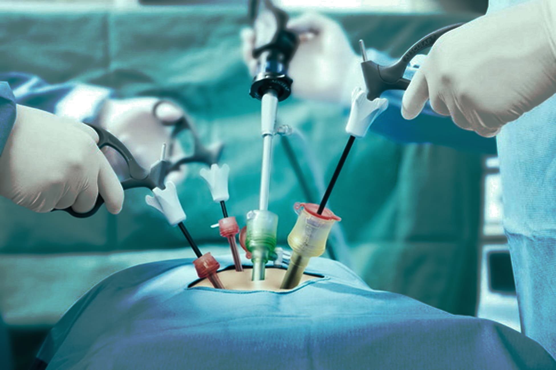 Surgery